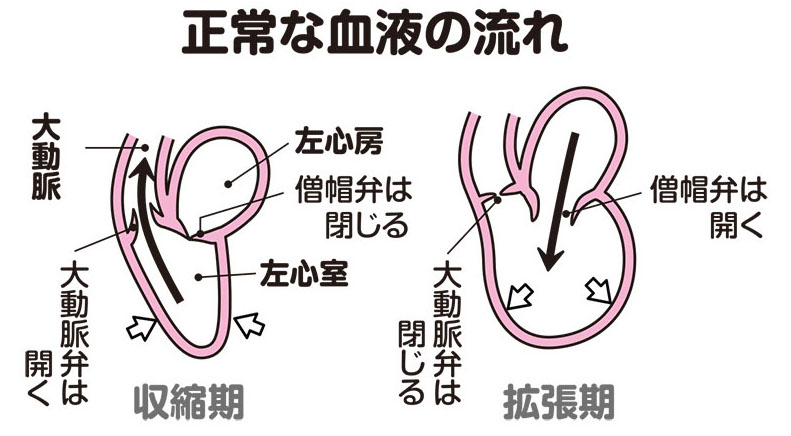 正常な血液の流れ